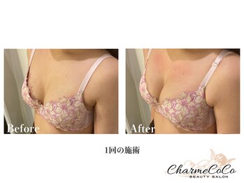 シャルムココ 蔵前店(CharmeCoCo)/お客様Before→After