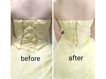 レゾン 京橋店/【Before/after】ブライダル