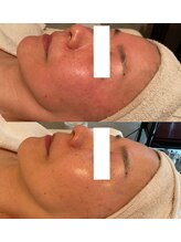 アンジェラックス 福岡天神店/