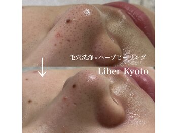 リベルキョウト 京都駅前店(Liber Kyoto)/毛穴レス艶肌コース
