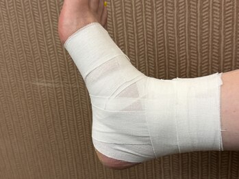 門司駅やわらぎ鍼灸整骨院/テーピング