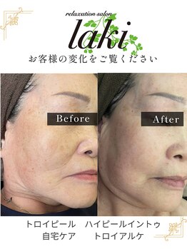 リラクゼーションサロン ラキ(laki)/トロイピール
