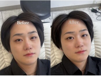 ジレース オモテサンドウ(JILEYES omotesando)/眉毛/眉毛パーマ/メンズ眉毛