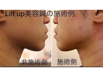 セットアップ鍼灸院(setup鍼灸院)の写真
