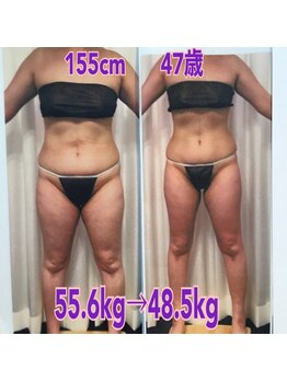 ボディエステティック アクアオーラ 富山店/太った人生にさようなら