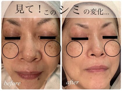 ビーフリー(Be free)の写真