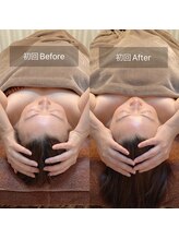 スリージー/before／after