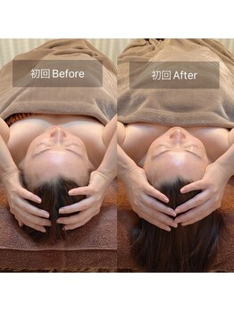 スリージー/before/after