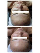 エクラ(eclat)/☆サロンケアとホームケア☆