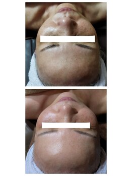 エクラ(eclat)/☆サロンケアとホームケア☆