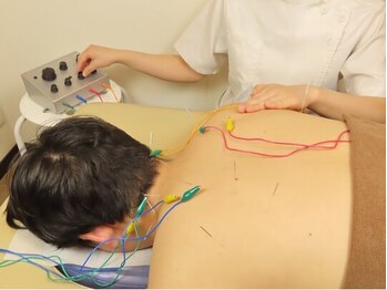 ビファイン鍼灸治療院 梅ヶ丘南口院/鍼施術　パルス