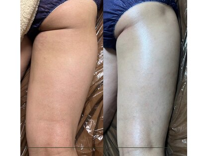 タミー(tummy)の写真