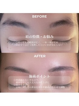 クリル(Kuril)/ビフォーアフター20代女性♪