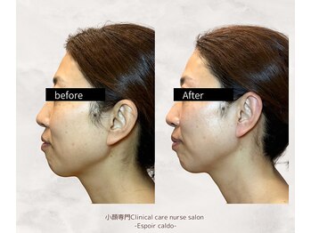 エスポワールカルド(Espoir caldo)/