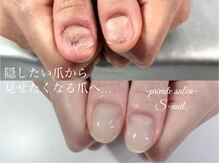 エスネイル(S-nail)