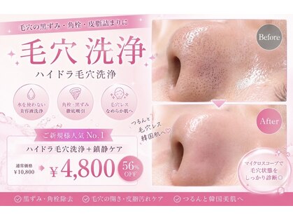 ハーシークレット(Her secret)の写真