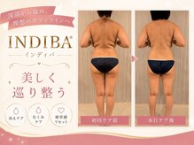 ハナヨサロン(hanayo salon)の雰囲気（《痩身》インディバで深部加温。ダイエット効果や肩こりも撃退◎）