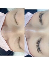 アイグロス(Eye Gloss)/