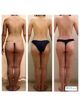 ホアロハ(HoAloha)/アロマリンパマッサージ