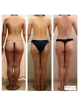 ホアロハ(HoAloha)/アロマリンパマッサージ