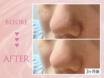 クリアラボ 川崎(Clear Lab)/韓国肌管理&毛穴洗浄専門店