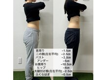 アークス(ARQS)の雰囲気（痩身メニューのお客様の結果♪サイズ以上に見た目に変化！）