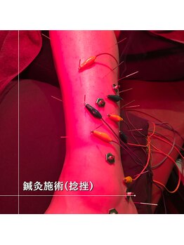 うぃず鍼灸整骨院/【施術例９】