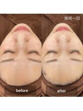 アムール(.Amour)/透明感UP！光フェイシャル