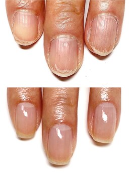 エムフルール(M fleur)/自爪育成メソッド