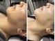 ラグ(LUXU)の写真/《艶肌小顔を目指すならLUXUに!》お顔の筋肉をほぐしてキュッと引き締め◎艶肌と小顔を同時に叶えることも!