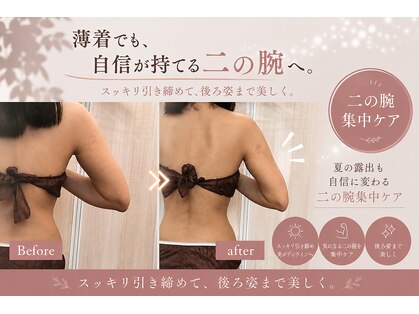 スリラ(SuriLa)の写真