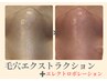 【2回目以降のご来店】毛穴詰まり取り放題+マシーンで美容液導入¥22000