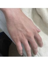 ナノハナ/鹿沼市の全身脱毛美容室ナノハナ