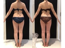 リボディ 表参道(An re Body)/before→after