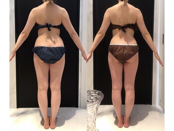 リボディ 表参道(An re Body)/before→after