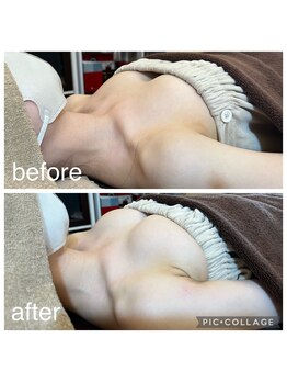 ベルダ(Beldad)/ボンボンバスト