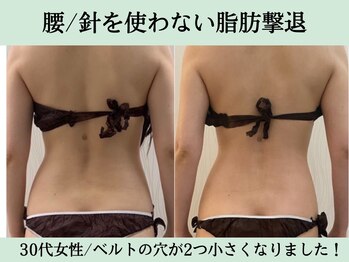 ソルニス(Solnis.)/痩身☆脂肪分解/ハイパーナイフ