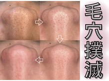 アモル(amor)/毛穴レスな肌は叶う♪