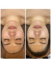 スリーズララ(Cerise LaLa)/