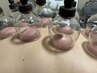 【健康エステ】健康維持に！血液の循環を改善！カッピング♪