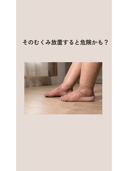 ファミーユ 新宿店/【むくみの放置は危険】