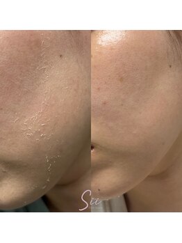 ジュエッテ(jouete)/シーナジーピール