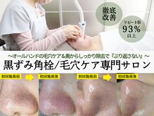 ティーツリー(Tea Tree)