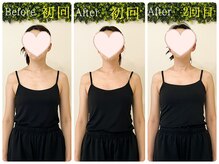 美容整体 綾の雰囲気（【最新小顔美顔器導入】デンキバリブラシ＆痩身機器）