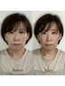 【たるみ改善☆フェイスラインスッキリ】小顔矯正＋ヘッドスパ約70分