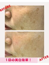 ユーフォリア(Euphoria)/美白は継続が大切