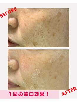 ユーフォリア(Euphoria)/美白は継続が大切