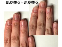 クウ(KUU)/肌改善も一緒に！