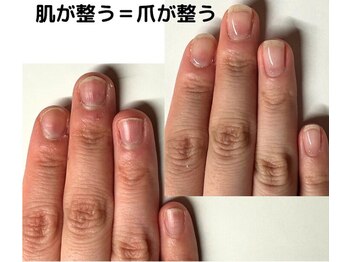 クウ(KUU)/肌改善も一緒に!