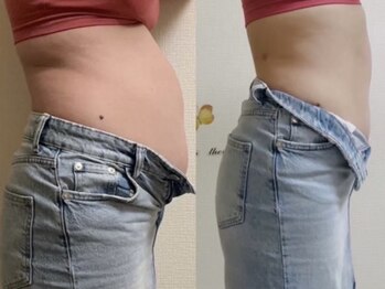 ヨサパーク ベル(YOSA PARK Belle)/産後も綺麗に痩せる！